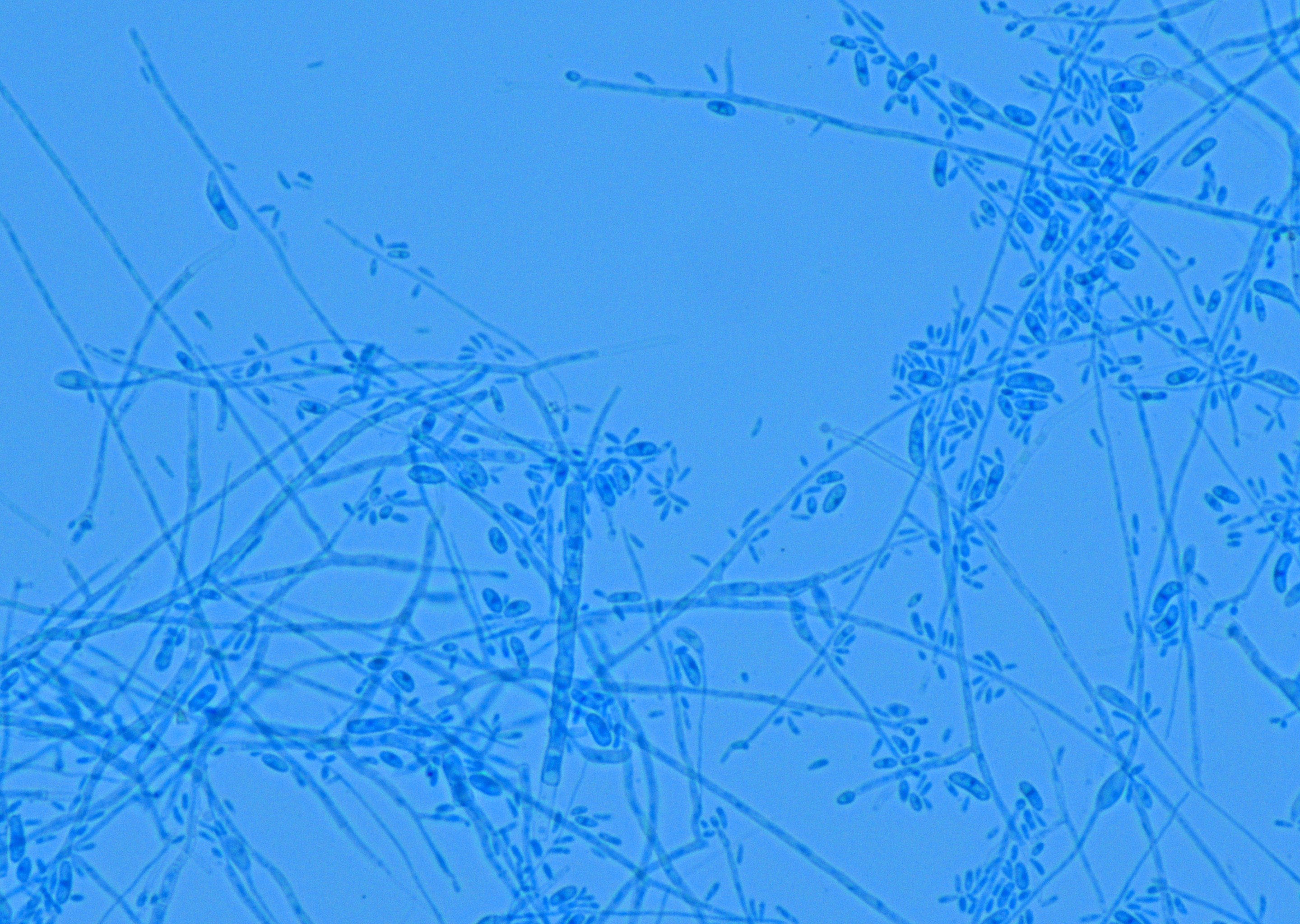 菌株显微形态展示